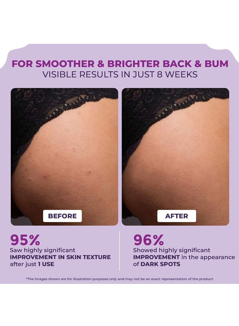 Sanfe Back & Bum Cream for Dark Spots and Body Acne for Women 100gm - Image 2