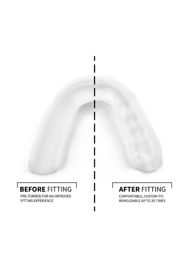 SOVA 3D Night Guard with Case - 2.0mm Thin - Custom-Molded Fit - Protects Against Nighttime Teeth Grinding & Clenching - Odor & Taste Free - Remoldable Up to 20 Times - Non Toxic - Image 2