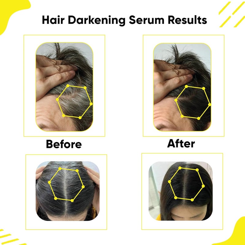 Masofta Anti Grey Hair Darkening Serum Reverses Limits Hair Beard Greying Promotes Shinier Hair With Arcolys Melano Gray Biotin Bhringraj For Both Men Women 30ML - Image 2