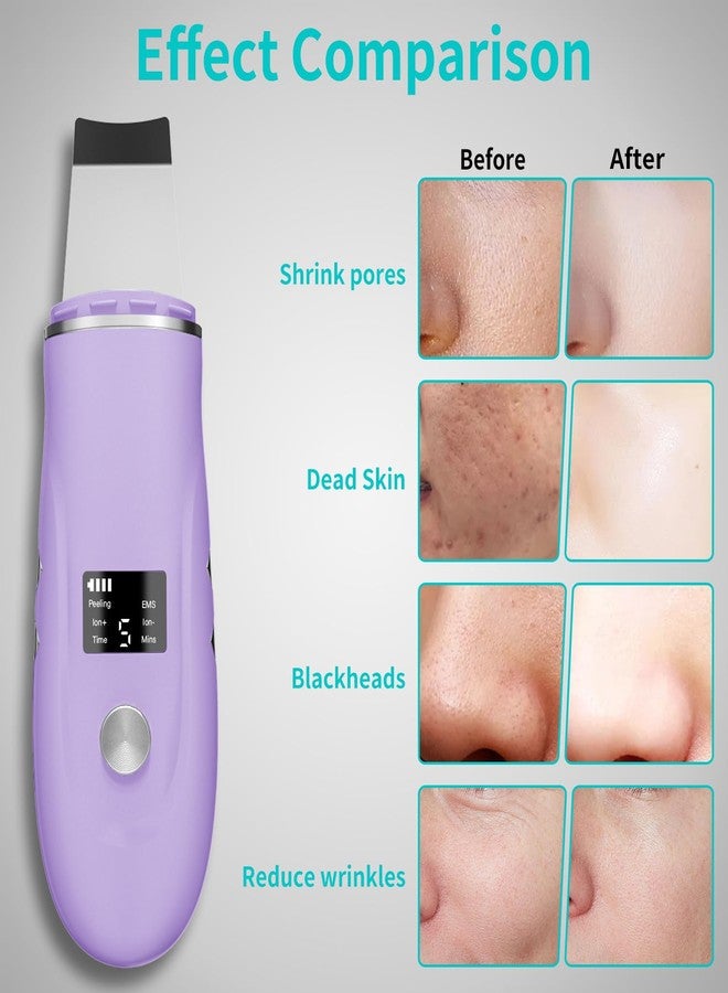 QYCSL Face Scrubber Skin Spatula - Blackhead Remover Deep Cleansing Tool for Pore Extraction, 4-in-1 Fast Charging Dock Blackhead Remover Face Spatula for Facial Skincare Women Gift (Purple) - Image 4