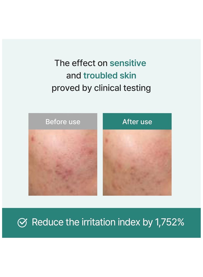 آي أم فروم أمبولة عرق السوس المهدئ، 73% عرق السوس الكوري، إكسوسوم، غير كوميدوغينيك، 30 مل - Image 5