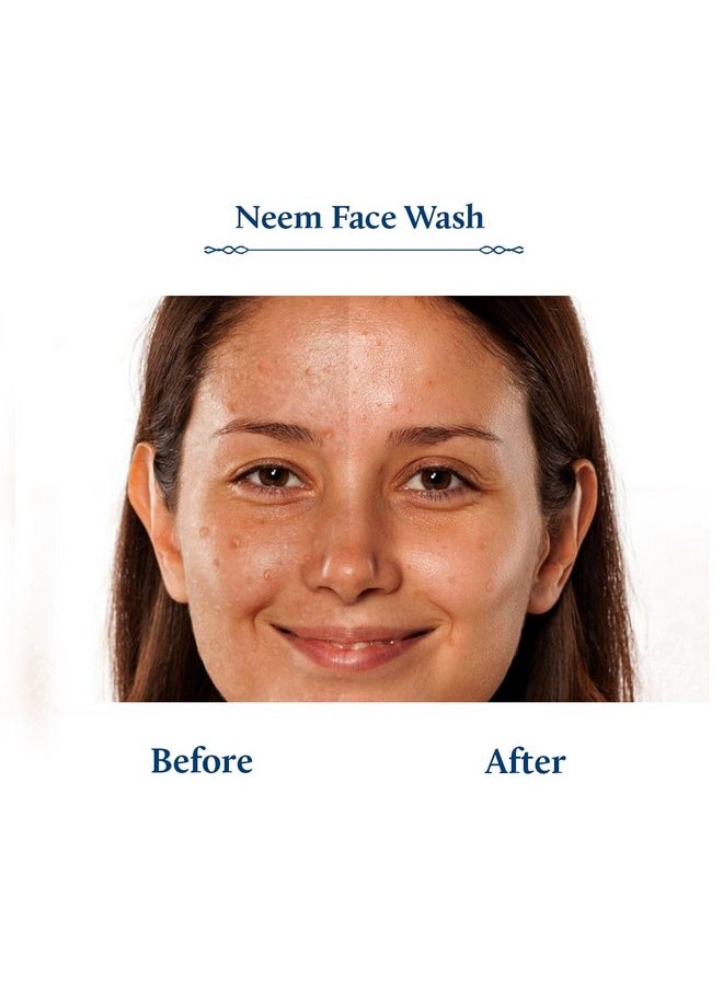 Blue Nectar Plant Based Vitamin C Face Wash For Women And Men | Face Wash For Acne & Pimple With Neem & Honey | Natural Cleanser For Face With Ayurvedic Herbs (11 Herbs, 100 Ml)  - Image 4