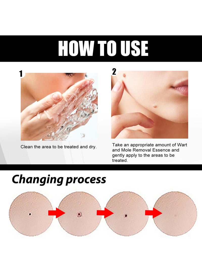 إيلهو skin mole removal dont be embarrassed by skin tags make your skin smooth 10ml - Image 5