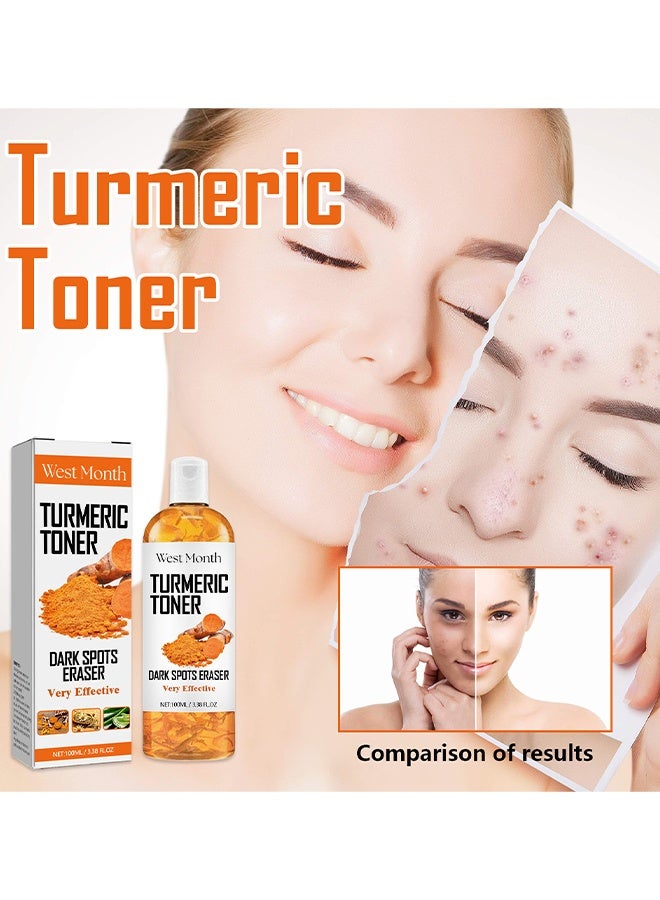 WEST MONTH Turmeric Refreshing Toner, Deep Moisturizing With Hyaluronic Acid & Natural Turmeric, Facial Toner For Acne Prone Skin, Evens Skin Tone, Anti-Wrinkle, Long-Lasting Hydration, Soothing, Dark Spot Correcting Hydrating Face Toner, 100ml - Image 2