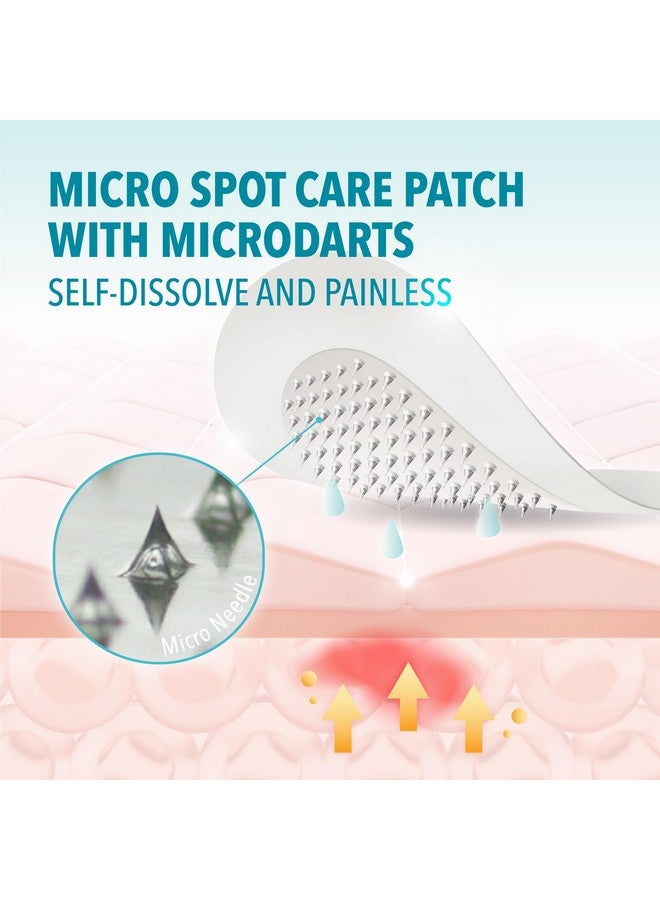 لافلير رقعة ميكرو سبوت كير ذاتية الذوبان من ميكرودارت لعلاج حب الشباب والبقع التي تستهدف البقع المبكرة للمكفوفين التي يصعب الوصول إلى حب الشباب للوجه والبشرة. حاصلة على براءة اختراع (متوسطة 17 ملم) - Image 3