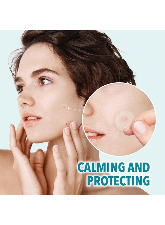 لافلير رقعة ميكرو سبوت كير ذاتية الذوبان من ميكرودارت لعلاج حب الشباب والبقع التي تستهدف البقع المبكرة للمكفوفين التي يصعب الوصول إلى حب الشباب للوجه والبشرة. حاصلة على براءة اختراع (متوسطة 17 ملم) - Image 5