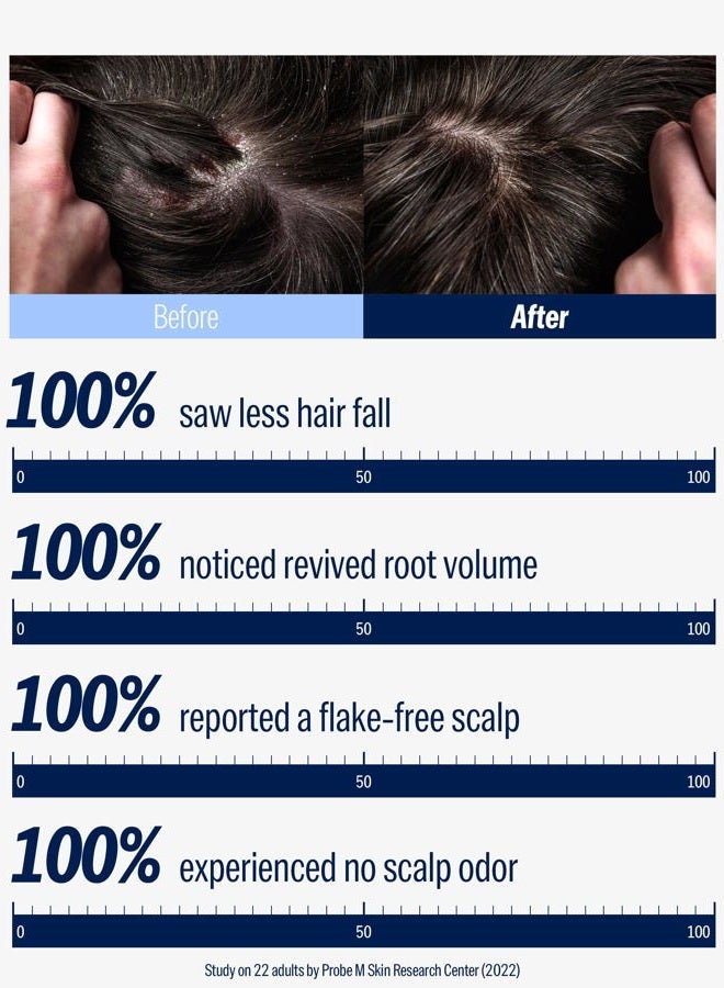 Dashu شامبو فروة الرأس اليومي داشو للطب الشرقي - Image 2