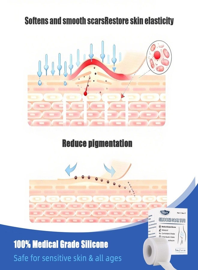 Nepia Silicone Scar Sheets 1.6"x120" Roll (3M) - Medical Grade | Reusable Scar Tape to Flatten & Fade Surgical Scars, C-Section, Keloids, Burns | Hypoallergenic Treatment (Clear) - Image 3