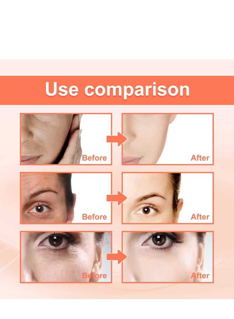 EELHOE Rose oil VC anti wrinkle essence, facial firming, removing legal lines, lifting head lines, moisturizing and moisturizing - Image 2