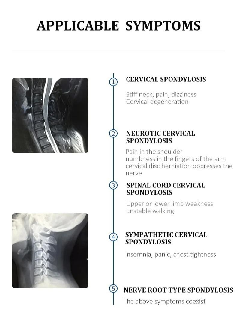 LK Adjustable Cervical Collar Soft Neck Brace, LK020A - Light blue - pzsku/Z8595C4D4DB2AEA4B91FCZ/45/_/1689776579/34da42d4-417b-44d7-9ea1-b9771fc9bd9f