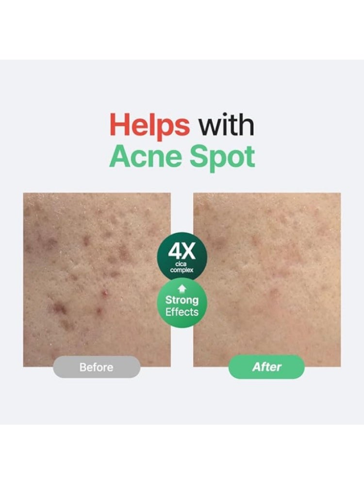 بوريتو تهدئة البشرة الحساسة والمتهيّجة – سيروم بوريتو وندر ريليف سينتيلا بدون عطر لعلاج الاحمرار وتقوية الحاجز - Image 5