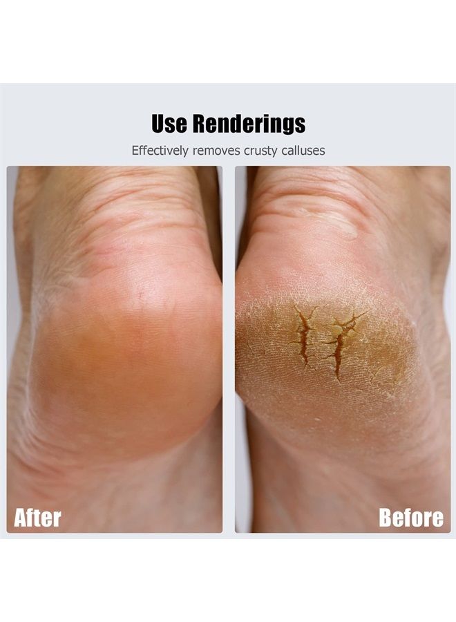 Ancable Replacement Heads for Flawless Pedi, Replacement Roller Refills Heads Compatible with Finishing Touch Flawless Pedi Electric Tool File, 6-Pack ( 3 Black Coarse and 3 Gray Fine ) - Image 3