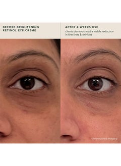 RANAVAT BOTANICS Ranavat Brightening Retinol Eye Crème Anti Aging Eye Cream And Dark Circle Corrector To Help Target Fine Lines Enriched With Microencapsulated Retinol Bakuchi Seed & Saffron (0.5 Oz)  - Image 4