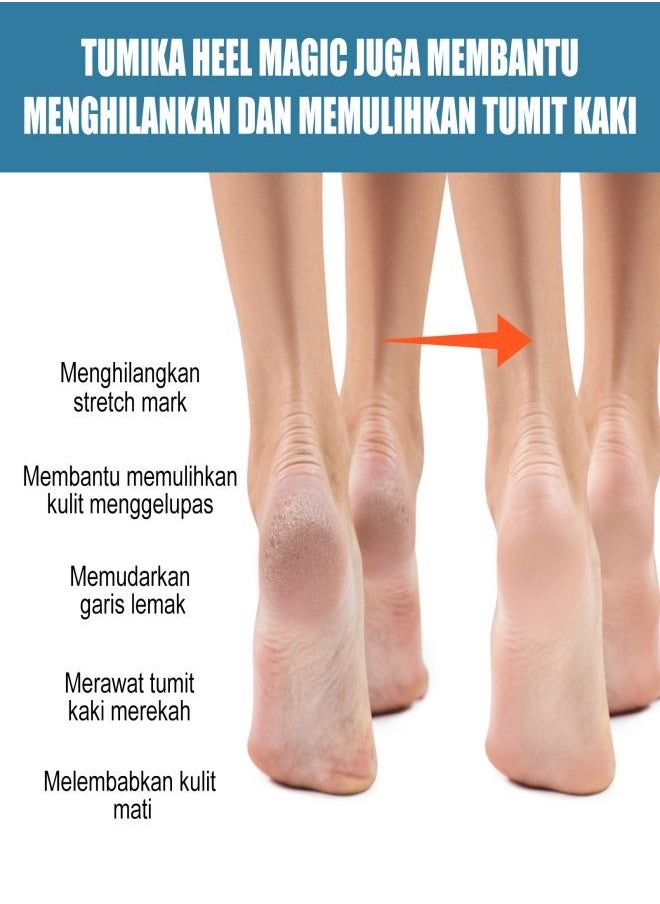 SOUTH MOON - Heel care cream, containing vitamin E and shea butter, suitable for people with dry and cracked heel skin or those who wear high heels for a long time, 50ml. - Image 1