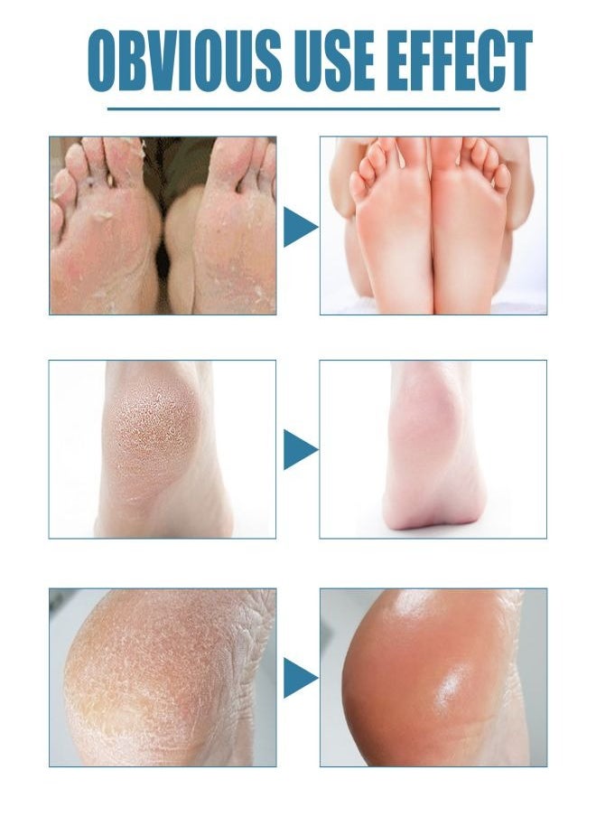 SOUTH MOON - Heel care cream, containing vitamin E and shea butter, suitable for people with dry and cracked heel skin or those who wear high heels for a long time, 50ml. - Image 1