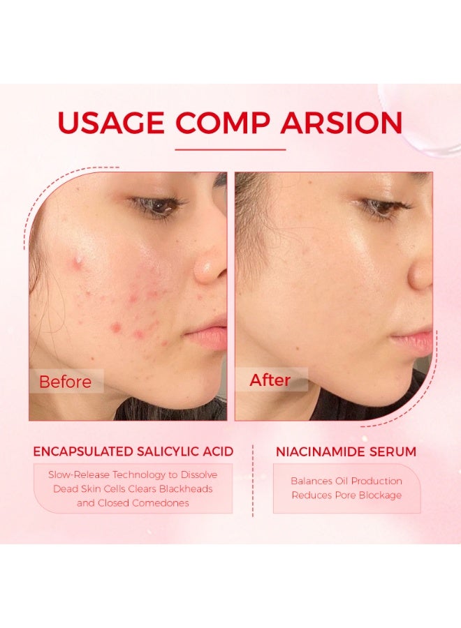 OUKEYA 3-PACKS 2% Salicylic Acid Acne Water, Oil Control, Repair, Fade Acne Scars, Delicate Skin 10ml*3 - Image 2