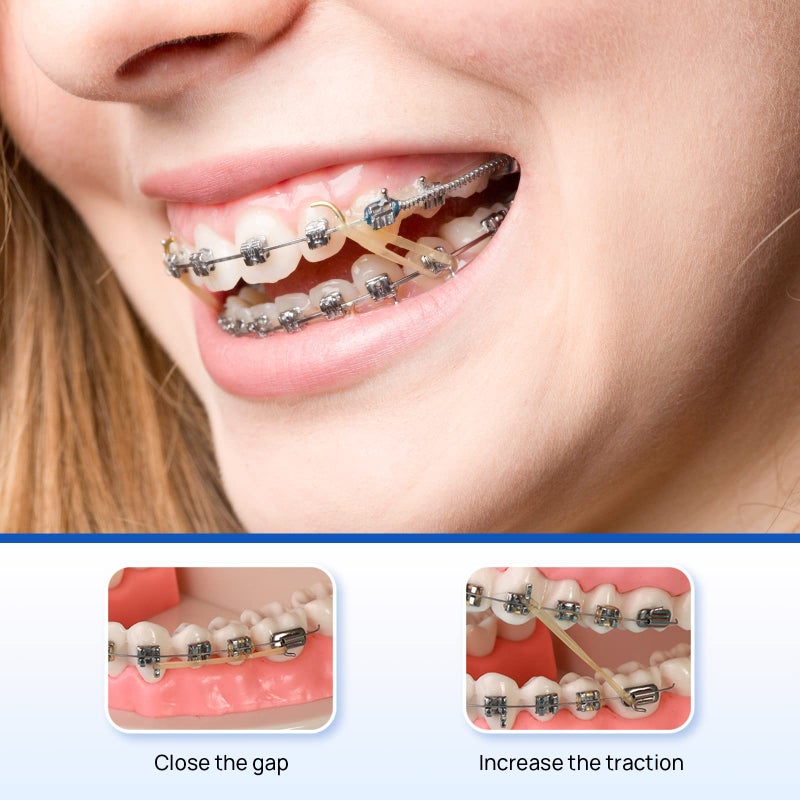 JMU 100 pack Orthodontic Elastics 1/4 Inch 6.5oz Heavy Intraoral Elastic Bands Latex Free Dental Rubber Bands Made in USA - Image 3