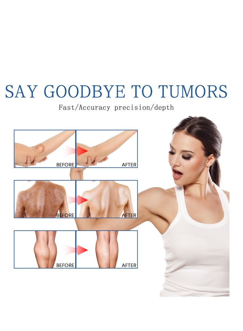 ساوث مون بخاخ إزالة الورم الشحمي ، بخاخ العناية بالورم الشحمي ، بخاخ خال من التكتلات ، تقليل الورم الشحمي ، بخاخ مشكل الجسم المضاد للسيلوليت للرجال والنساء ، بخاخ مهدئ للورم الشحمي ، 50 مل - Image 5