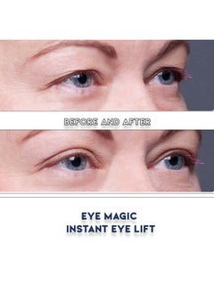 Eye Magic Premium Eye Lift (S/M Refill) Made In The Usa. Instantly Lifts And Defines Droopy Sagging Or Hooded Eyes Safe For Daily Use  - Image 5