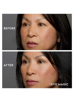 Eye Magic Premium Eye Lift (S/M Refill) Made In The Usa. Instantly Lifts And Defines Droopy Sagging Or Hooded Eyes Safe For Daily Use  - Image 3