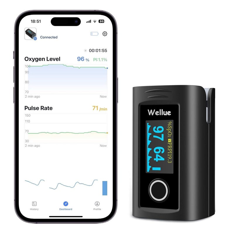 ViATOM Bluetooth Pulse Oximeter Approved UK Builtin Offline Storage Oxygen Monitor finger Adults for Heart Rate Blood Oxygen Saturation Includes Carrycase and Lanyard Free APP - Image 1