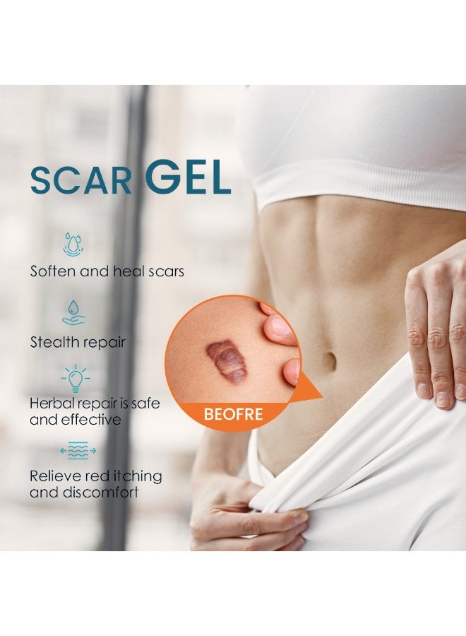 Sumifun Scar Gel, Scar Repair, Medical-Grade Silicone, Old & New Scars, Improve Texture & Color, Reduce Scars, Suitable for Surgical Scars (e.g., C-section), Burns, Acne Scars, Stretch Marks, etc., 30g - Image 4