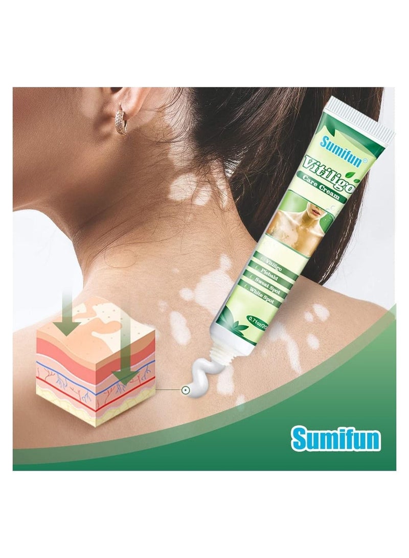 Sumifun Vitiligo Care Cream Reduces White Spots on Skin, Pigmentation regulating, Improve Skin Pigmentation, 4 Counts Upgraded Vitiligo Creams - Image 2