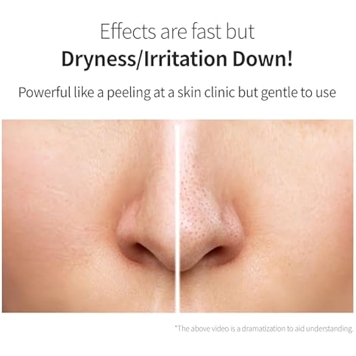 Benton Glycolic Acid 7% Exfoliating Toner with Niacinamide - Gentle AHA Toner for Brighter Skin & Even Tone - Balances Oil & Moisture - Hydrating, Cruelty-Free Korean Skin Care - Image 5