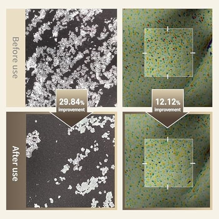 Benton Glycolic Acid 7% Exfoliating Toner with Niacinamide - Gentle AHA Toner for Brighter Skin & Even Tone - Balances Oil & Moisture - Hydrating, Cruelty-Free Korean Skin Care - Image 2