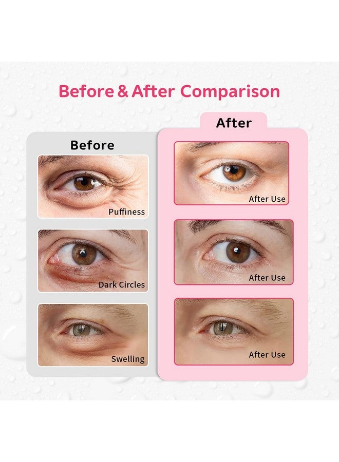 CONBELLA مجموعة 4 قطع من حزم الثلج الجل للعيون قابلة لإعادة الاستخدام ضغط بارد وساخن للعيون حزمة ثلج للعيون وسادات تبريد للعيون للإجهاد والتورم والاحمرار والهالات السوداء والعيون المنتفخة والتعافي بعد الجراحة. - Image 3