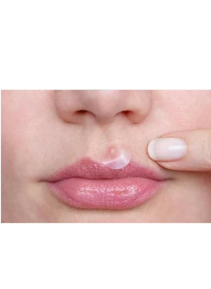 Cure aid Cure-Aid Acne Plaster 24pcs  - Image 3