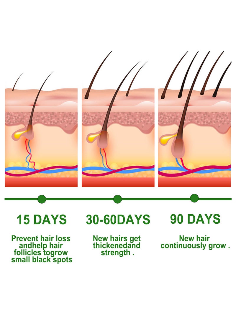 EELHOE Rosemary Essential Oil For Hair Growth Skin Care  - Image 4