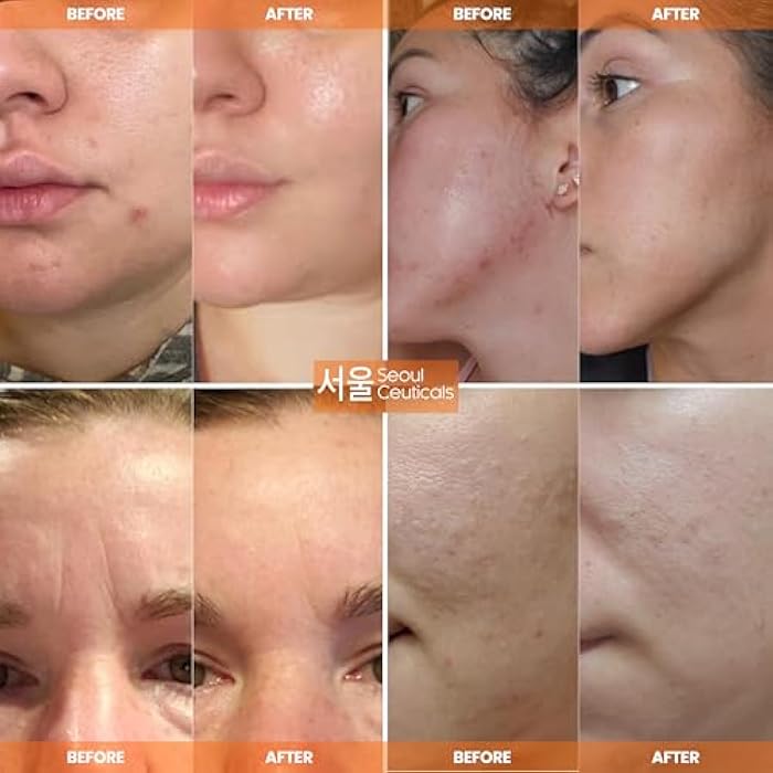 SeoulCeuticals Snail Mucin Moisturizer 97.5% - Korean Skin Care Snail Repair Cream - Day & Night Anti Aging K Beauty Skincare Cruelty Free 2oz - Image 3