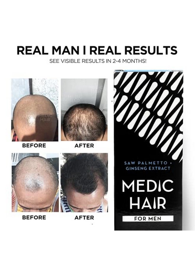 MEDIC HAIR For Men 90Ml 3.04 Fl Oz Contains Saw Palmetto And Ginseng Extract Dht Blocking Natural Healthy Hair Growth - Image 5