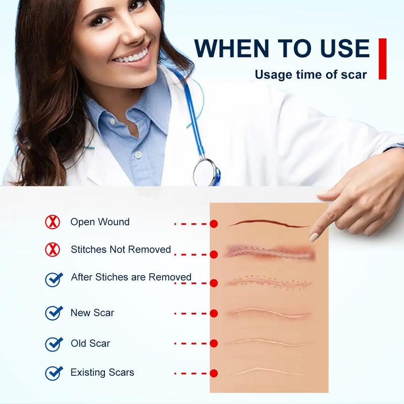 MINGYITUO Silicone Scar Sheets Tape for Surgical Scars C Section Scar Silicone Strips Medical Grade Reusable Soften and Flattens Scars Breast Keloid Professional Scar Patches 16x115 Inch - Image 3