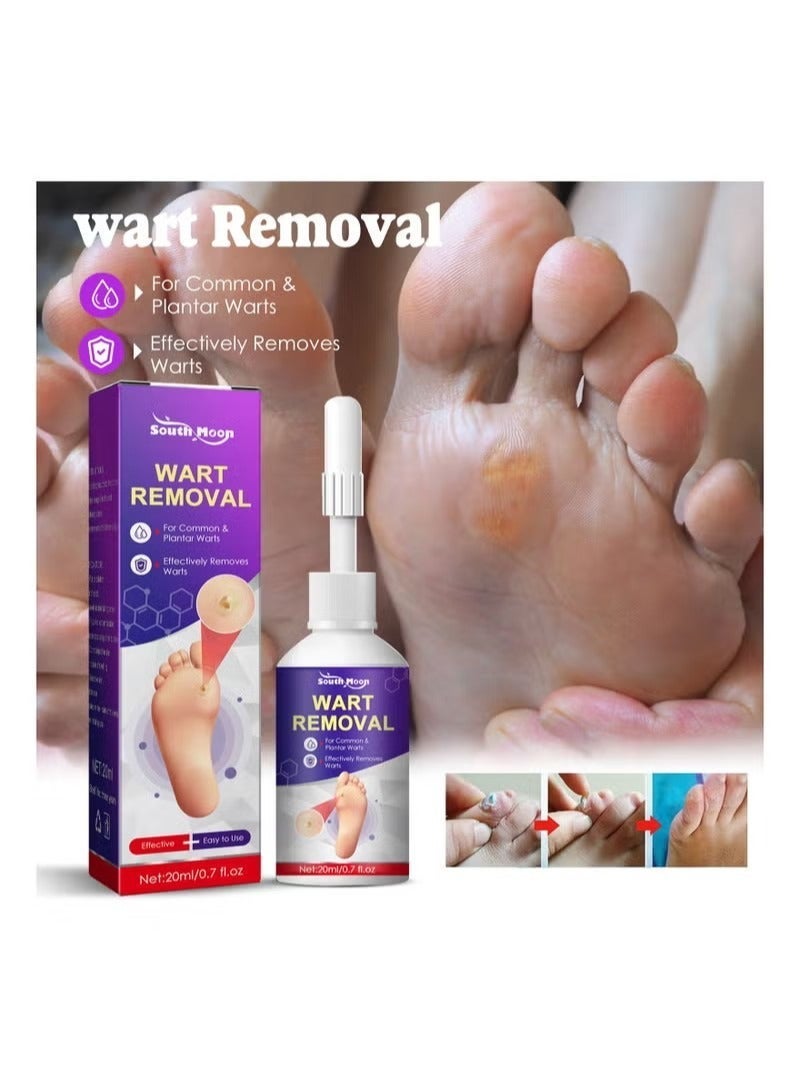 SOUTH MOON Remove chicken eye lotion Extra freckles Remove chicken calluses skin care foot pad - Image 2