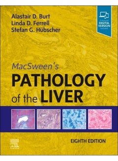 MacSween's Pathology of the Liver 