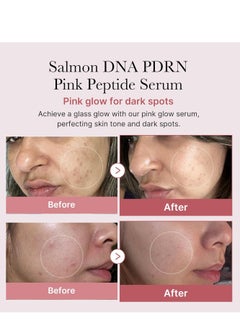 Medicube Medicube PDRN Pink Ampoule, 10,000 ppm Blend, PDRN Salmon, Serum, Salmon Injection, Hypoallergenic, Beam, Korean Cosmetics, PDRNmedicube pdrn pink peptide serum 30ml  - Image 2