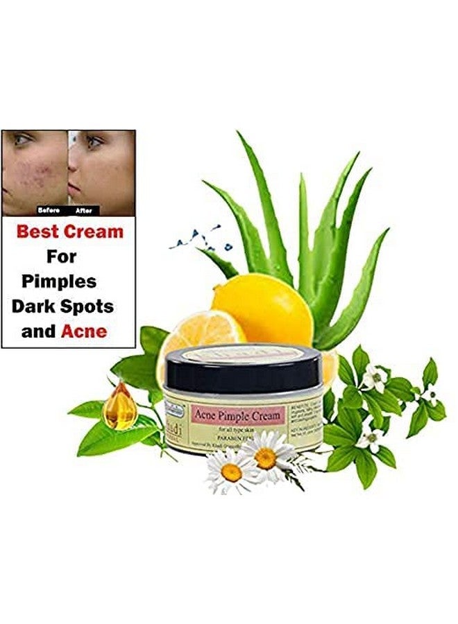 Khadi Rishikesh Ayurvedic Anti Acne Pimple Removal Face Cream For Reduce Acne Scars & Marks Cream -Controls Acne, Pimples -Reducing Acne Spots-Clear & Glowing Skin-à¤ªà¤¿à¤®à¥à¤ªà¤² à¤à¥à¤°à¥à¤® UNISEX -Paraben Free,Pack Of 2-50gmx2=100 GM,With RUMAAL FREE - Image 2
