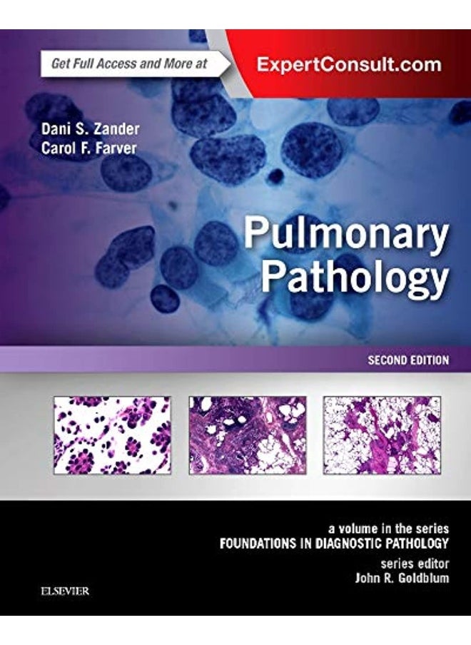 Pulmonary Pathology: A Volume in the Series: Foundations in Diagnostic Pathology 