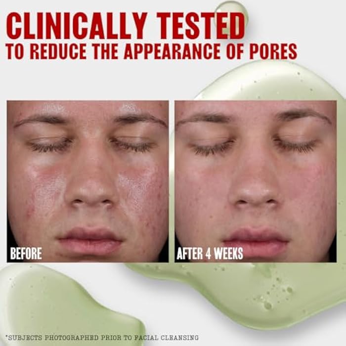 Thayers Oil Balancing and Cooling Jelly Toner, Pore Reducing Facial Toner That Mattifies and Hydrates, Skin Care for Combination to Oily Skin, 12 Fl Oz - Image 4