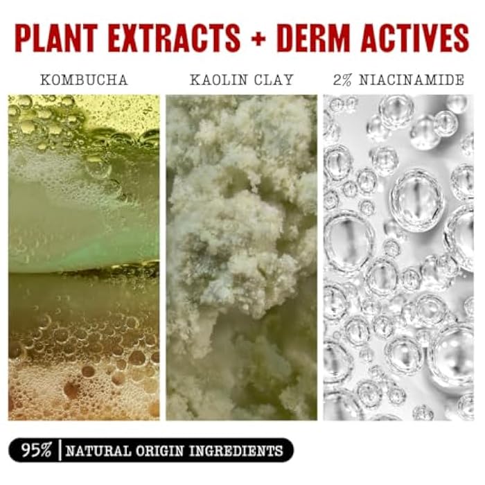 Thayers Oil Balancing and Cooling Jelly Toner, Pore Reducing Facial Toner That Mattifies and Hydrates, Skin Care for Combination to Oily Skin, 12 Fl Oz - Image 5