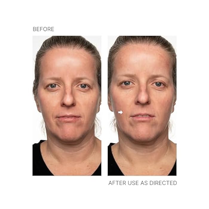 Nu Skin - Face Lift with Activator (Original Formula) | Helps Lift and Tighten Your Face and Neck for a Youthful, Firm Appearance, Reducing Lines and Wrinkles, Enhancing Skin Tone and Texture - Image 5