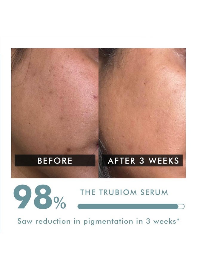 CONSCIOUS CHEMIST 5% Niacinamide Serum | 30Ml | Serum For Pigmentation And Dark Spot, Alpha Arbutin & Tranexamic Acid Face Serum, For Acne Scars & Uneven Skin, Face Serum For Men & Women - Trubiom - Image 5