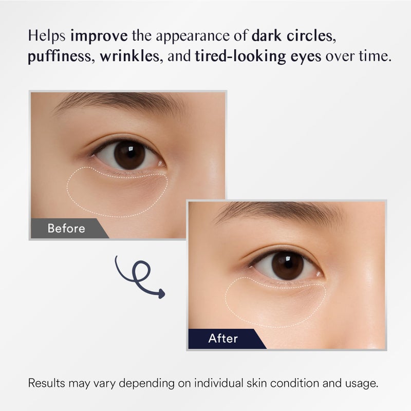uikeaft Under Eye Patches for Dark Circles: 30 Pairs Eye Gel Mask for Puffy Eyes and Bags with Retinol Collagen - Undereye Brightening Hydrating Anti-Wrinkles Women - Image 3