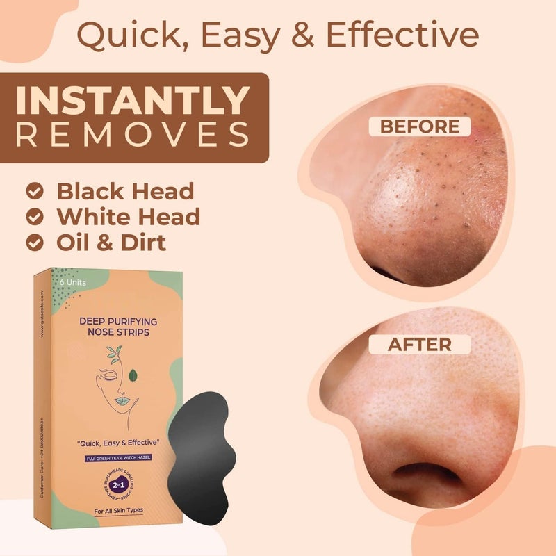 Generic Deep Purifying Nose Strips for Women  Men  Instant Removes Whiteheads Blackheads Pore Strips and Deep Face cleanses poresInstant Result Cleaner  Minimizer  - Image 4