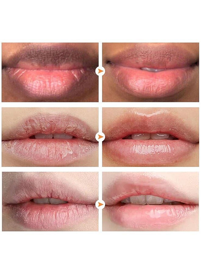 Mixiu 2PCS Lip Magic Lighten Scrub Cream, Dark Black Lip Removal Exfoliation Pigmentation, Fade Dull Pink Lip Balm Brighten, Anti-Crack Moisturizing, Smooth Lips, Gentle Exfoliator For Chapped And Dry Lips - Image 5