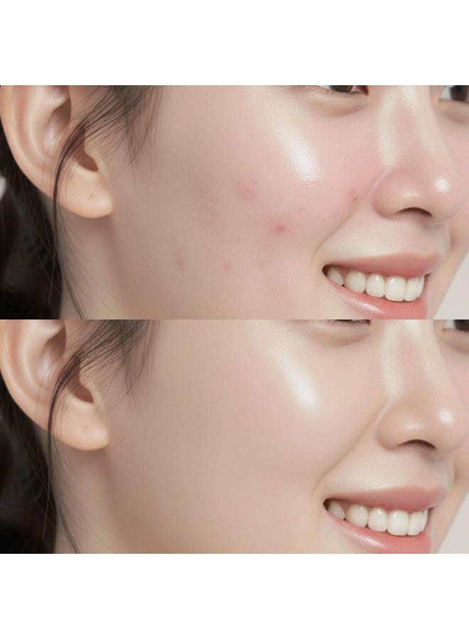 CARENEL Anti-Melasma Deer Cream Anti Melasma CICA Cream Skin Care Korean Cosmetics - Image 4