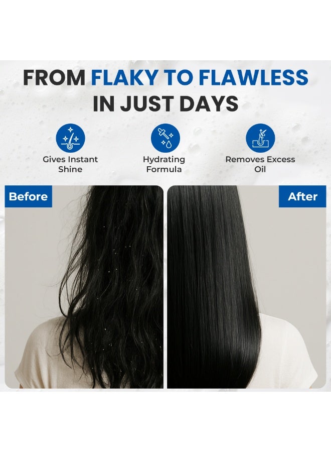 SZ Star Anti Dandruff Shampoo for Men & Women | Cool Menthol Formula for Itchy Scalp Relief, Flake Control & Scalp Cooling | Daily Use Shampoo for All Hair Types | Fights Dandruff, Soothes Scalp & Prevents Dryness | Paraben-Free & Gentle | 600ml - Image 5