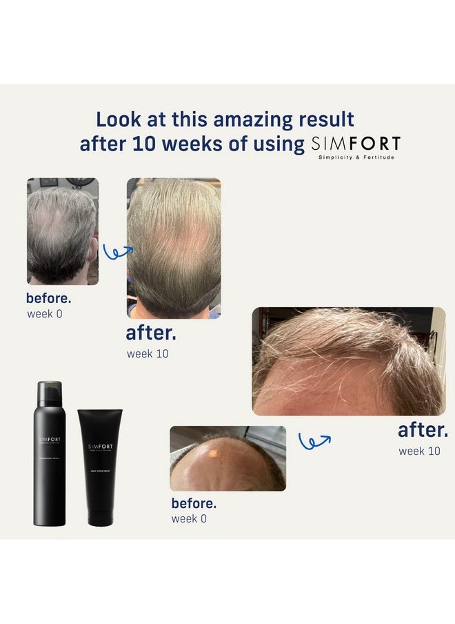 SIMFORT - Imfort Sparkling Scalp Shampoo+Conditioner For Thinning Hair And Hair Loss Hair Growth Treatment (Hair Growth Kit) - Image 1